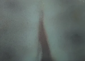 Abstract 1